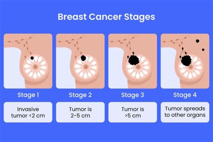 Can green tea cause breast cancer?