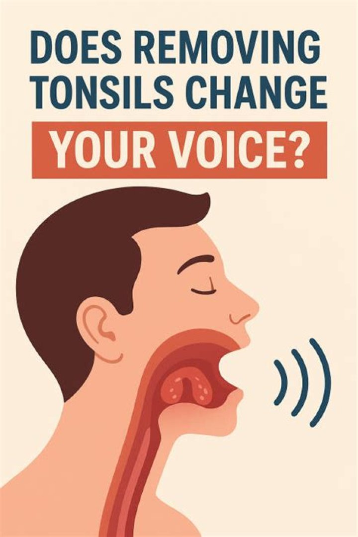 Does removing tonsils change your voice?