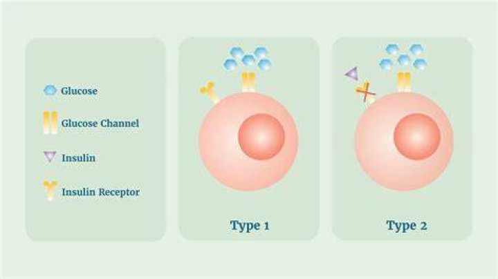 Is diabetes Type 2 a death sentence?