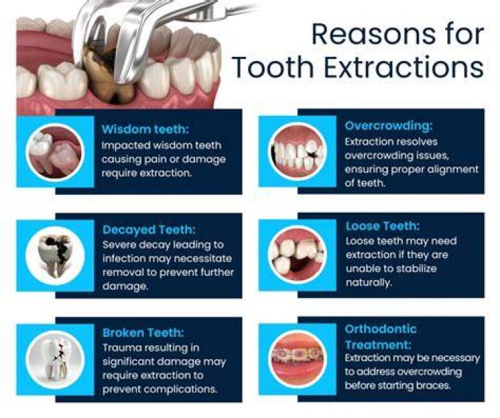 Is it painful to remove tooth?