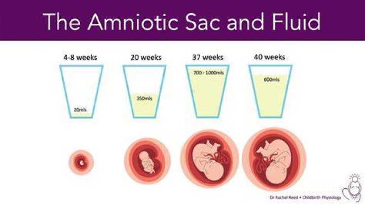 What color does amniotic fluid dry?