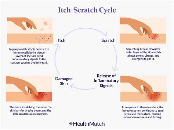 What is an itch caused by?