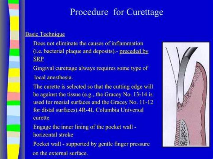 What is curettage and cautery?