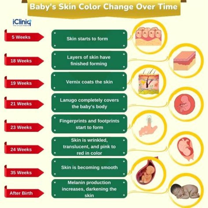 Which parent determines the skin color of baby?